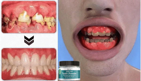 HZA™ Remineralizing Tooth Powder 25 16